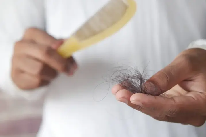 Qué es la alopecia