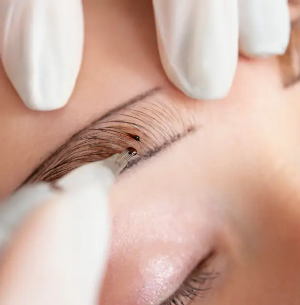 Trasplante de cejas en Alcoy