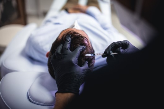Tratamiento capilar mesoterapia